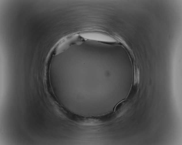 X0000085250387200703301815