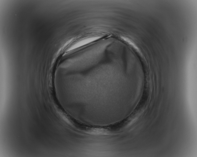 X0000085250399200703301815