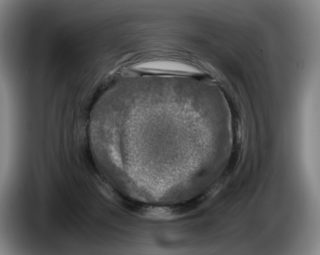 X0000085250409200703301814