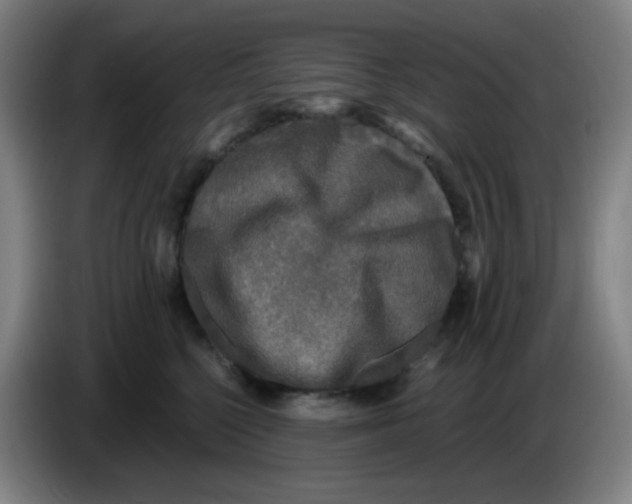 X0000085250568200703301813