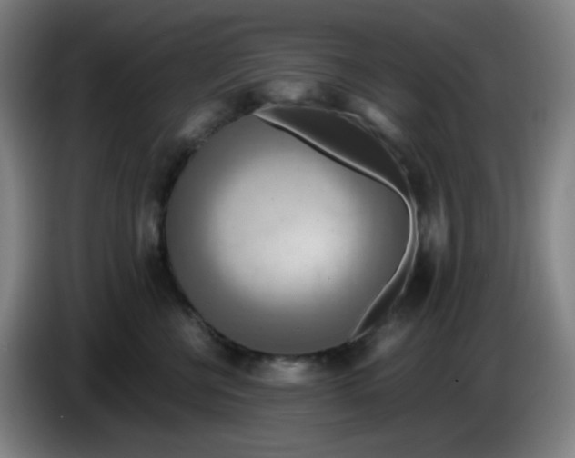 X0000085250570200703301813