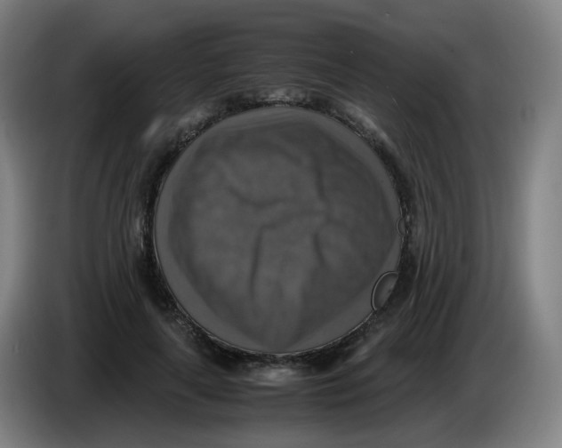 X0000085250643200703301811