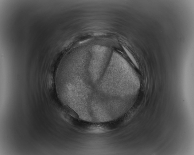 X0000085250704200703301810