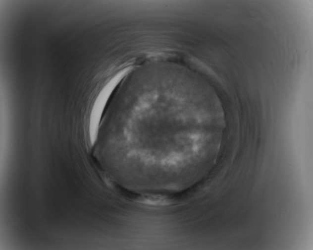 X0000085250720200703301810