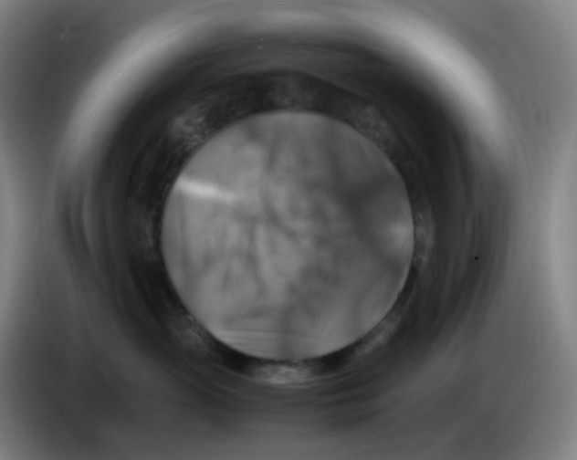 X0000085250765200703301810