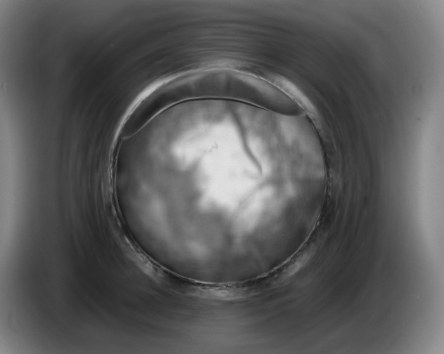 X0000085250948200703301807