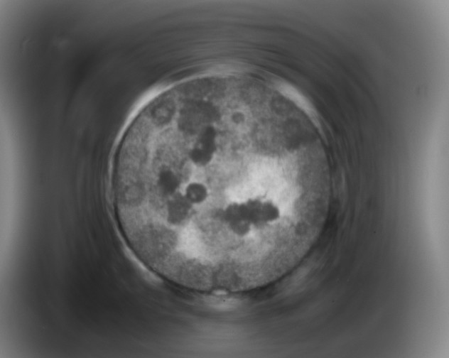 X0000085251103200703301805