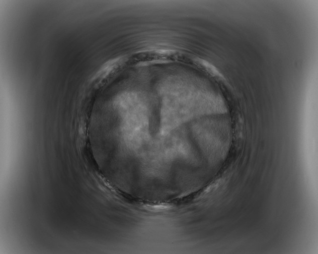 X0000085251110200703301804