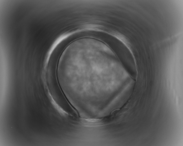 X0000085251152200703301805