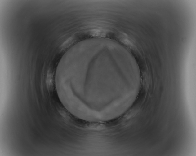 X0000085251154200703301804