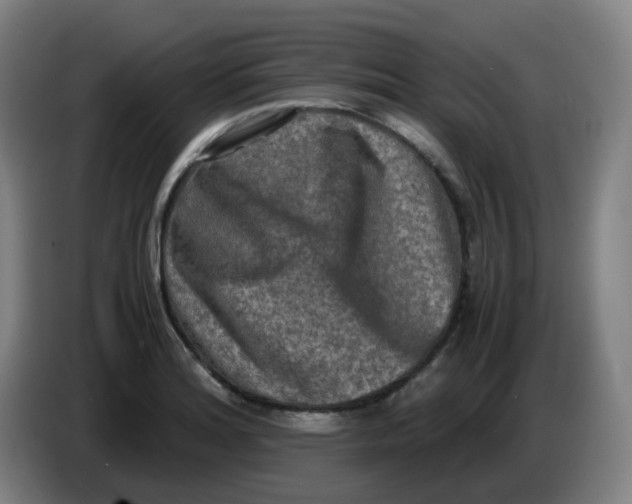 X0000085251180200703301803