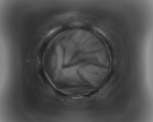 X0000085251303200703301801