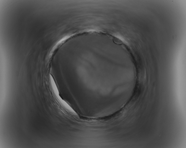 X0000085251359200703301800