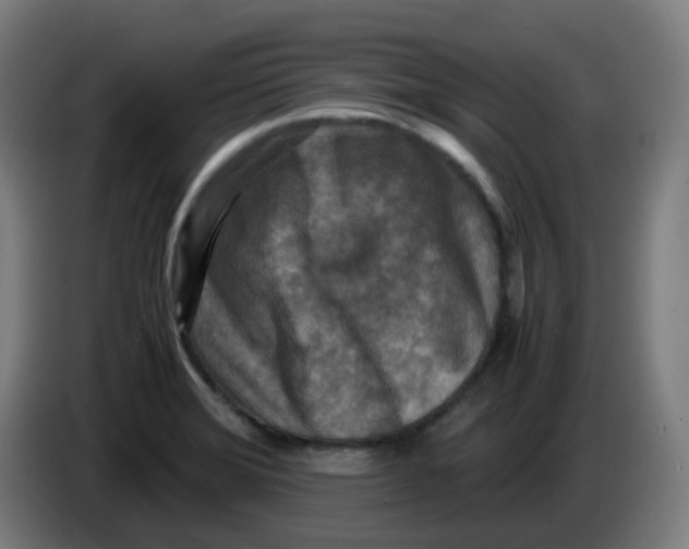 X0000085251372200703301800