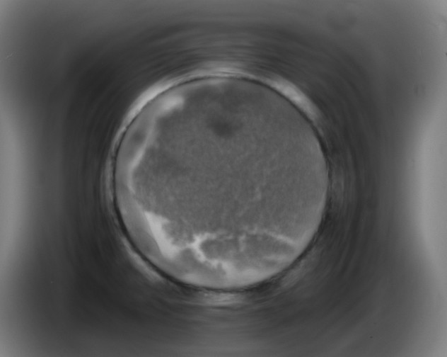 X0000085251382200703301800