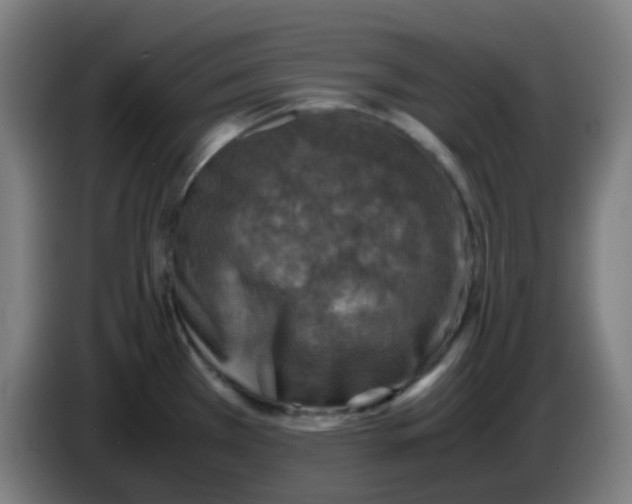 X0000085251385200703301800