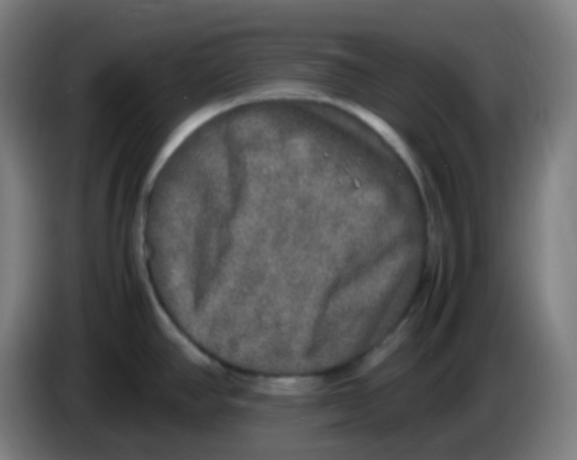 X0000085251390200703301800