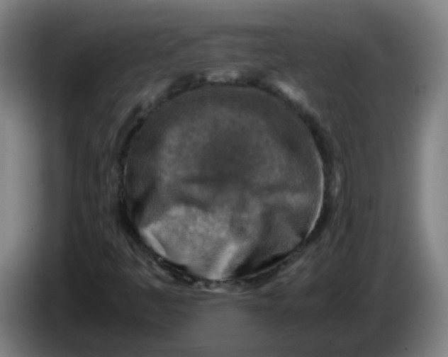 X0000085251445200703301759