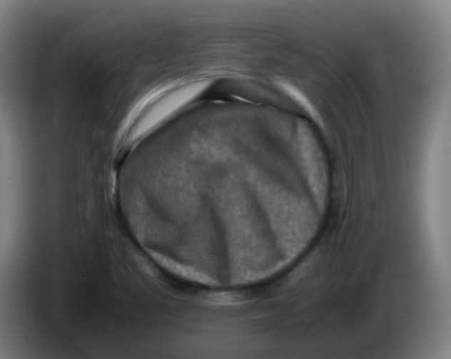 X0000085251461200703301759