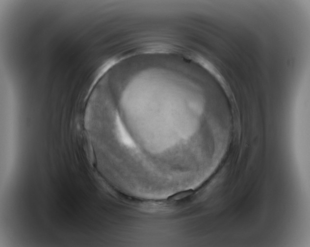 X0000085251481200703301758