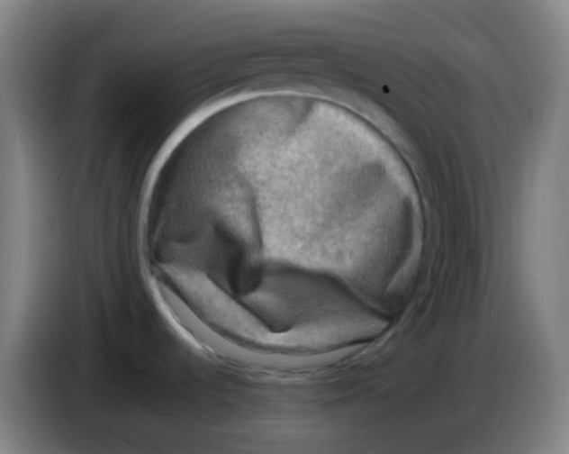 X0000085251536200703301758