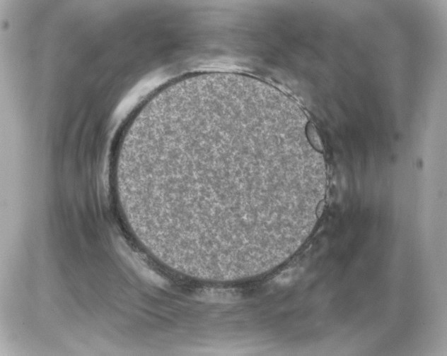 X0000085250296200704092056