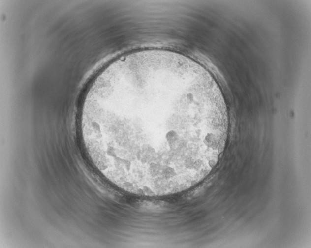 X0000085250346200704092054