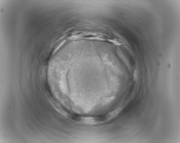 X0000085250409200704092054