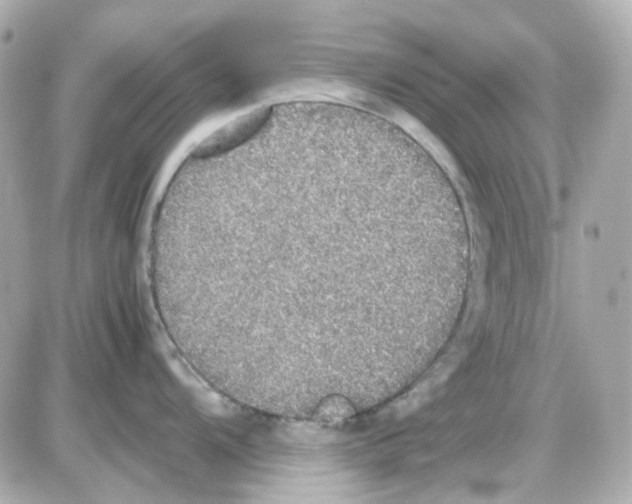 X0000085251104200704092042