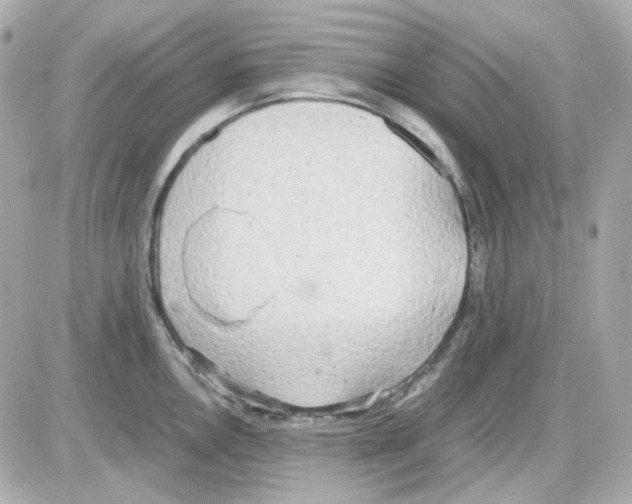 X0000085251146200704092042