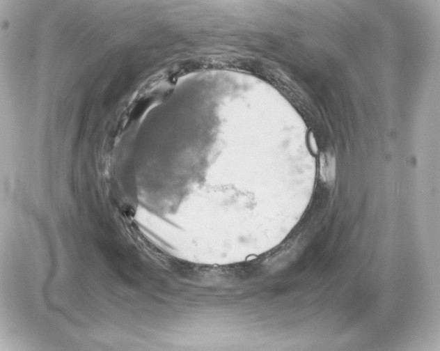 X0000085251155200704092041