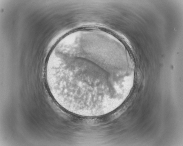 X0000085251279200704092039