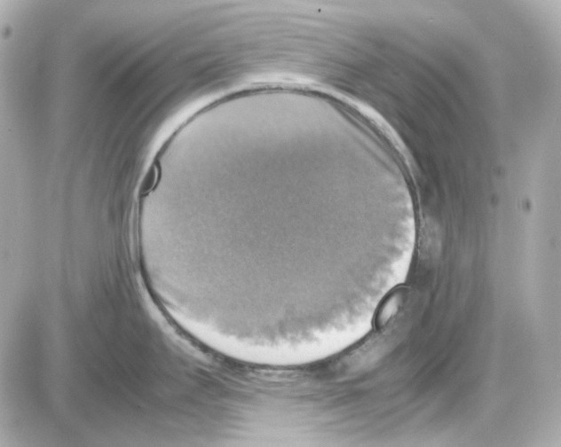 X0000085251295200704092039