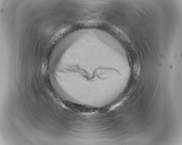 X0000085251300200704092038