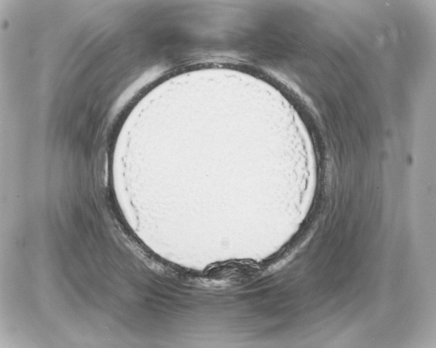 X0000085251317200704092039