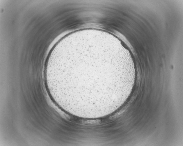 X0000085251339200704092039