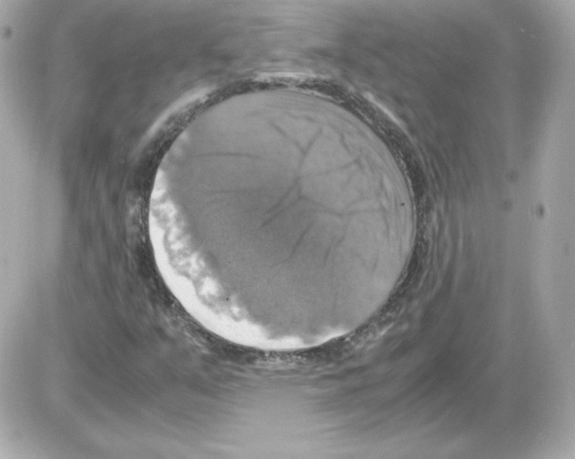 X0000085251351200704092038