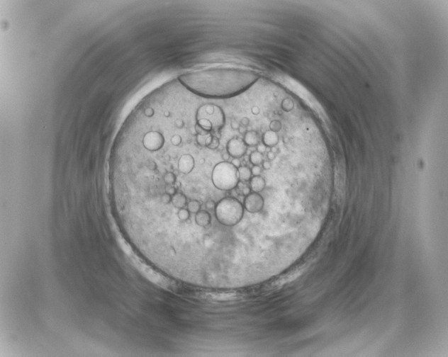 X0000085251431200704092037