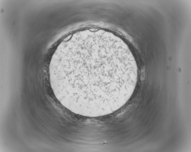 X0000085251496200704092035