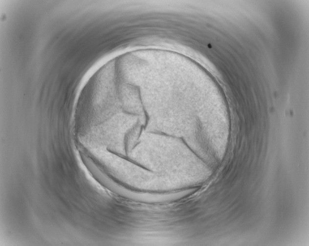 X0000085251536200704092036