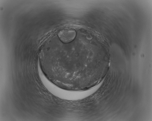 X0000085261397200703091311