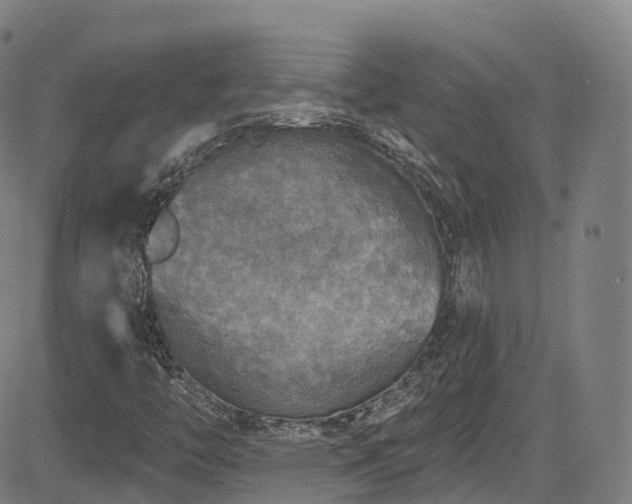 X0000085261446200703091311