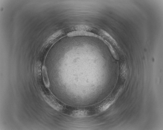 X0000085260356200703161410