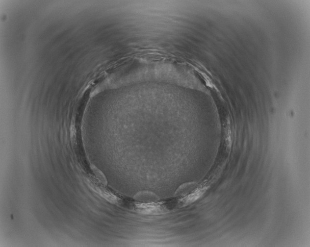 X0000085260516200703161407