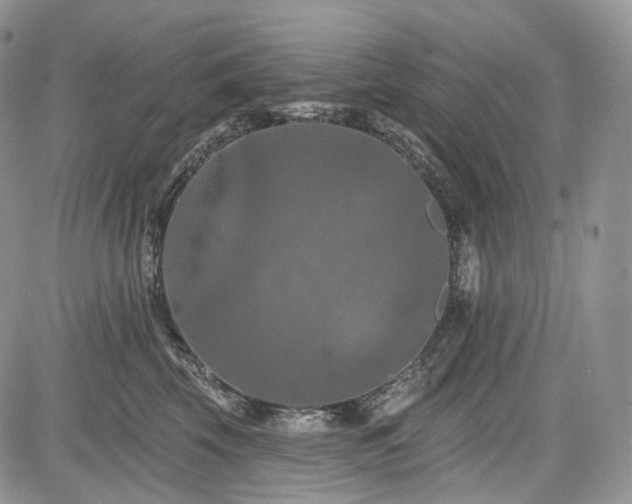 X0000085260569200703161407