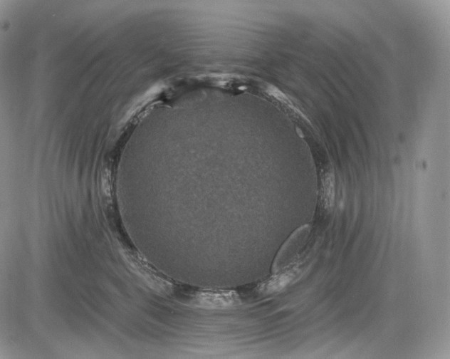 X0000085260571200703161407