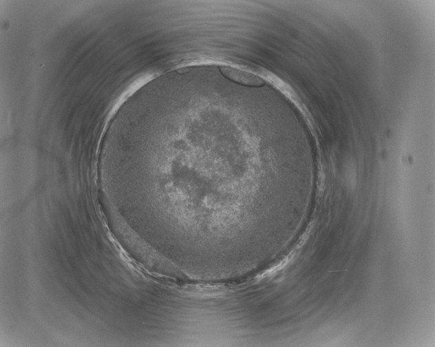 X0000085261145200703161357