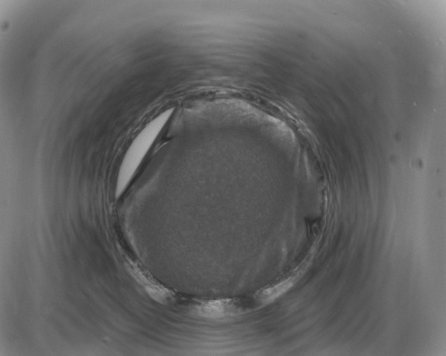 X0000085260382200703231721