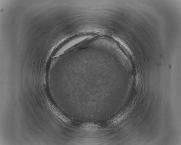 X0000085260399200703231720