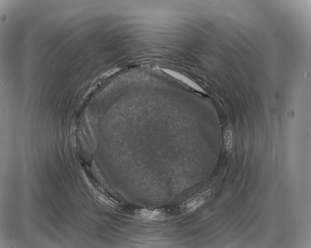 X0000085260570200703231718